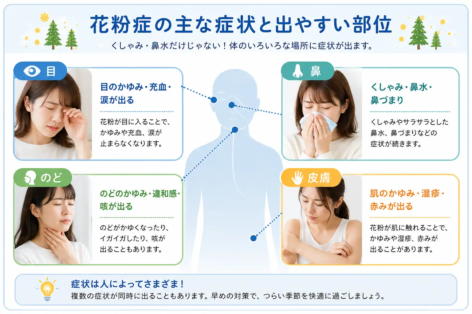 花粉症の主な症状と出やすい部位：目・鼻・のど・皮膚に症状が出ることを示した図